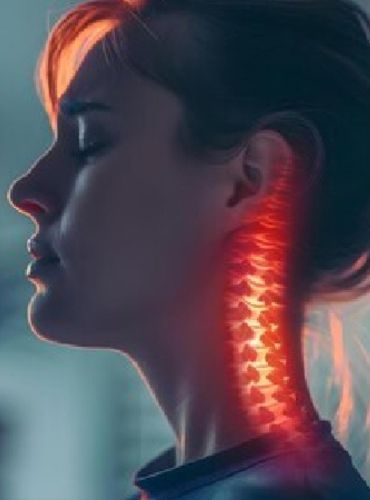 Cervical Spondylosis